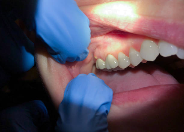 Best Dentist for Severe Toothache  in Lakeway, TX